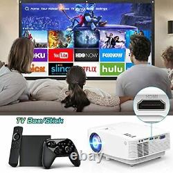 TMY WiFi Projector with 100? Screen 180 ANSI Brightness Over 7500 Lumens 1080